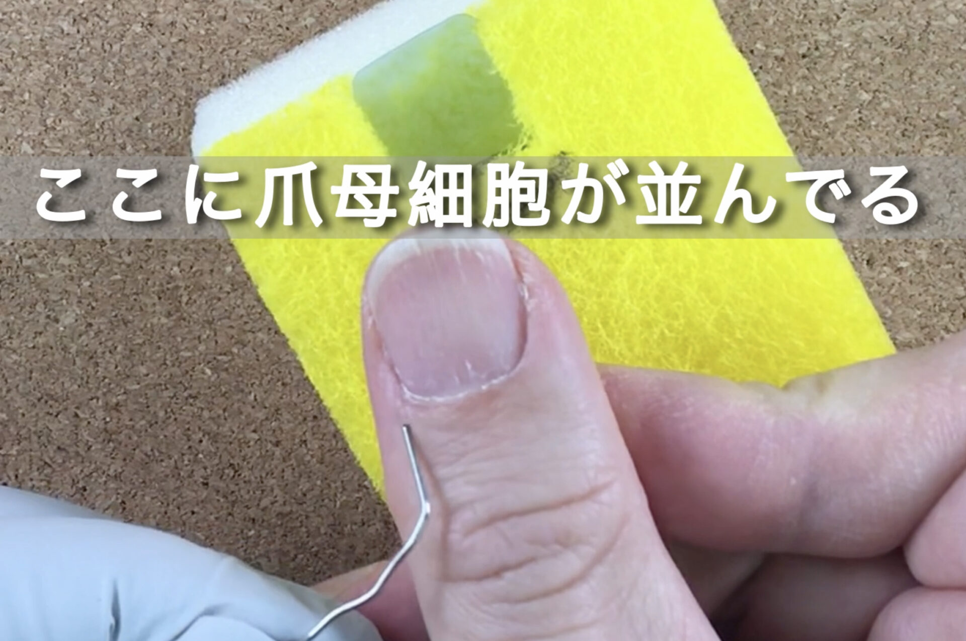 爪の処置ができるようになるための『爪のはなし』 | 手術上手くなる研究所 BUYSS labo 01
